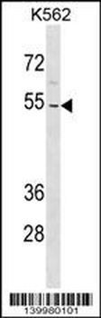 ZNF736 Antibody (N-term)