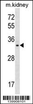 TIGAR Antibody (N-term)