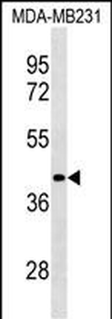 LRRC39 Antibody (N-term)