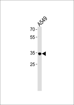 RHOXF2B Antibody (Center)