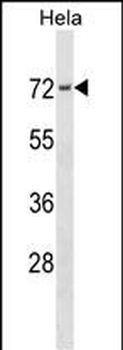 PRKCSH Antibody (N-term)