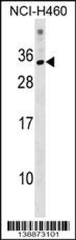 KRBOX1 Antibody (C-term)