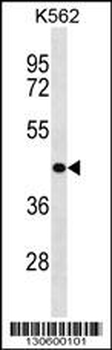 ZNF73 Antibody (N-term)