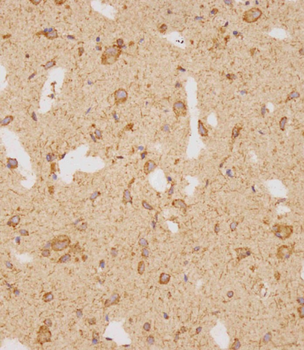 GATSL2 Antibody (N-term)
