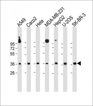 GATSL2 Antibody (N-term)