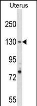 RFC1 Antibody (N-term)
