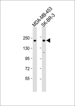 ERBB2 Antibody (Center S998)