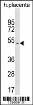 YR011 Antibody (Center)