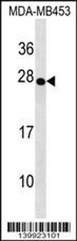 TRDC Antibody (Center)