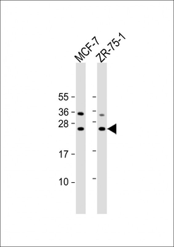 STAG3L1 Antibody (Center)