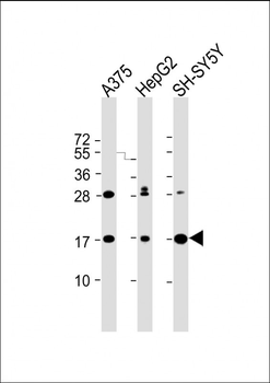 SRP14 Antibody (Center)