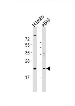 HSPB9 Antibody (Center)
