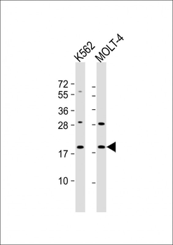 GKN1 Antibody (C-term)