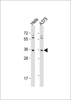 OR5AK2 Antibody (C-term)
