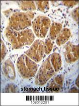 EIF2C2 Antibody (N-term)
