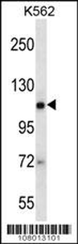 EIF2C2 Antibody (N-term)