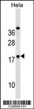 RNF224 Antibody (Center)