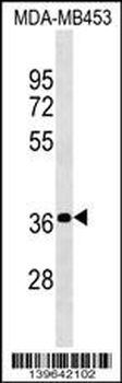 PSG4 Antibody (N-term)