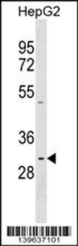 PRR23A Antibody (N-term)