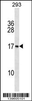PAPPAS Antibody (N-term)