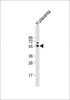 PSG6 Antibody (N-term)