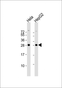PMM2 Antibody (C-term)