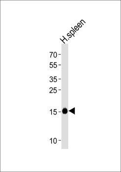 RNASE2 Antibody (C-term)