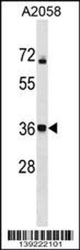 CALHM3 Antibody (N-term)