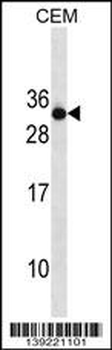 RAB4B Antibody (N-term)