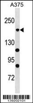 POLR1A Antibody (C-term)
