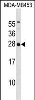 ITPA Antibody (C-term)