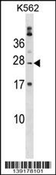 PABPC1L2B Antibody (C-term)