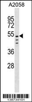 CLEC18C Antibody (C-term)
