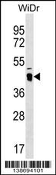 ATAD3C Antibody (Center)