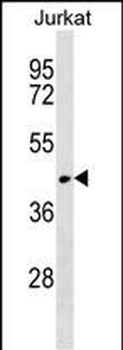 RUNDC3A Antibody (Center)