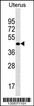 PRR25 Antibody (C-term)
