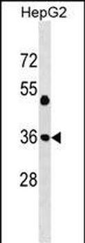 JUN Antibody (Center T93)