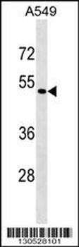 EIF2S3L Antibody (Center)