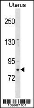 ZNF853 Antibody (N-term)