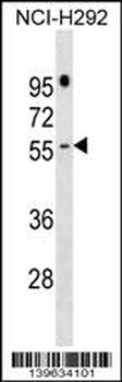 PRAMEF16 Antibody (C-term)