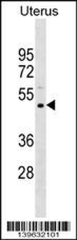 PRAMEF11 Antibody (Center)