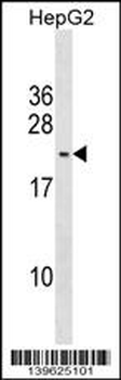 PMS2L5 Antibody (C-term)