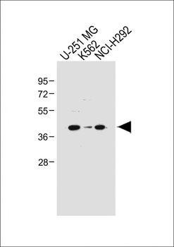 PCGF6 Antibody (Center)