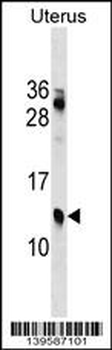 KLKP1 Antibody (N-term)
