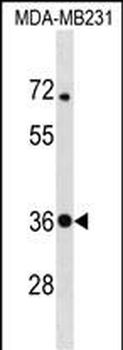STX4 Antibody (Center)