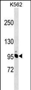 NCAPH Antibody (Center)