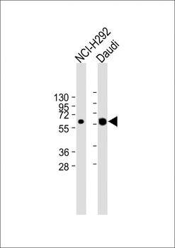 IFI44L Antibody (C-term)
