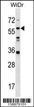 LRRC14B Antibody (N-term)