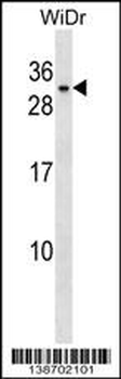 BHLHA9 Antibody (Center)