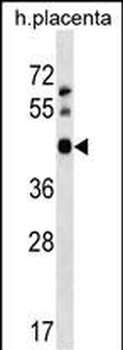 APOBEC3D Antibody (N-term)